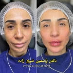 کلینیک پوست مو زیبایی و لیزر کیمیا