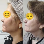 کلینیک زیبایی پوست و لیزر ایده آل