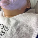 پاکسازی پوست کلینیک پوست تمیس