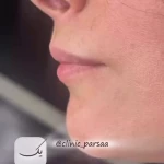 نمونه کار مرکز لیزر و کلینیک زیبایی پارسا