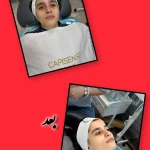 خدمات تخصصی پوست  غریبانی (بل اسکین کر)