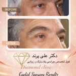 مرکزفوق تخصصی جراحی زیبایی دایموند(پوست)