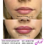 کلینیک لیزر , زیبایی و لاغری نوران