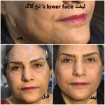 کلینیک زیبایی و لیزر مو گندم