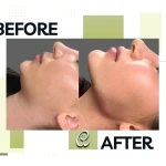 مرکز سلامت و زیبایی آمیس