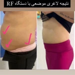  باشگاه ورزشی و ایکس بادی پرانیک(نیاوران)