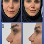 لوگوی کلینیک زیبایی دکتر زهره صادقی
