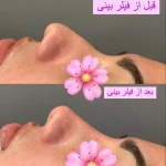 کلینیک زیبایی دلا