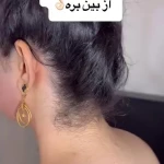 کلینیک لیزر و جراحی مینوسا