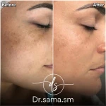 مطب پوست و مو زیبایی دکتر سما