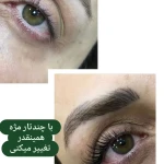 کاشت مژه