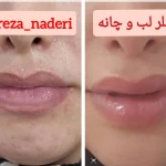 مرکز زیبایی و لیزر دکتر رضا نادری