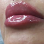 مطب پوست مو زیبایی دکتر معصومه روزگاری