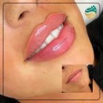نمونه کار کلینیک پوست,مو و لاغری دادمان