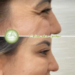 تصویر کلینیک زیبایی‌ سلین اسکین سنتر