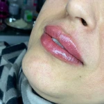 کلینیک زیبایی دکتر فاطمه کوچالی