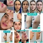 لوگوی کلینیک لیزر و زیبایی لیلیا