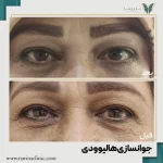 کلینیک پوست ، مو و لیزر نارینا