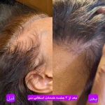 مرکز حرفه ای پوست و مو بهناز دست ورز