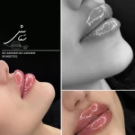 مرکز لیزر و کلینیک زیبایی و بوتاکس ستایش