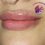مطب زیبایی دکتر مینو شعبانی