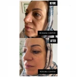 کلینیک پوست مو و زیبایی رکسانا