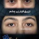 مرکز لیزر کلینیک زیبایی رزنیلای مرزداران