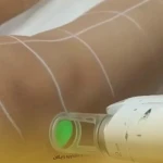  کلینیک لیزر الکس و زیبایی آنجل
