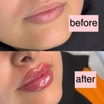 تصویر کلینیک تخصصی لیزر و زیبایی آیرین