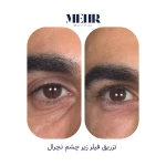 نمونه کار کلینیک زیبایی مهر استودیو