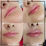 کلینیک پوست مو زیبایی و لیزر نیل