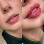 کلینیک پوست مو زیبایی و لیزر آیسل