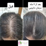 دکتر بهاره ملکی متخصص پوست ، مو و زیبایی