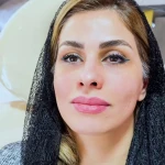 مرکز لیزر و زیبایی هانیسا