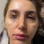 کلینیک پوست و مو و لیزر و زیبایی دنیز