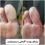 تصویر پدیکور و پودولوژیSD