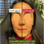 کلینیک لیزر وکلینیک زیبایی پایون(بانوان)