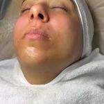 پاکسازی پوست کلینیک پوست تمیس
