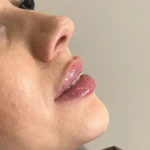 کلینیک زیبایی  و لاغری تخصصی میرای