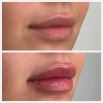 تصویر کلینیک پوست مو زیبایی و لیزر آیسل