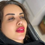 کلینیک زیبایی و لیزر دکتر میلاد گندمی