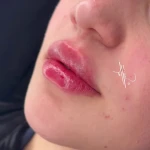 مطب پوست زيبايی ليزر دکتر شاه نعمت الهی