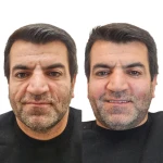 مطب زیبایی دکتر یوسف نظری