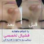 مرکز لیزر و فیشال دکتر خالقیان