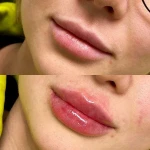 کلینیک پوست مو زیبایی و لیزر آیسل
