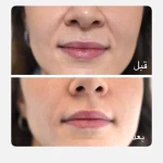 تصویر مرکز لیزر و فیلر وجوانسازی وزیبایی شاینا