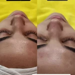  خدمات تخصصی پوست و فیشال رویا باقریان
