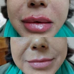 مطب پوست ،مو زیبایی دکتر فاطمه قره داغی