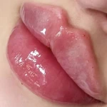 تصویر مطب پوست، مو و زیبایی و لیزر شبیرا