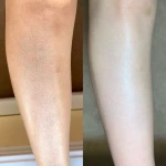 کلینیک لیزر و زیبایی یگانه